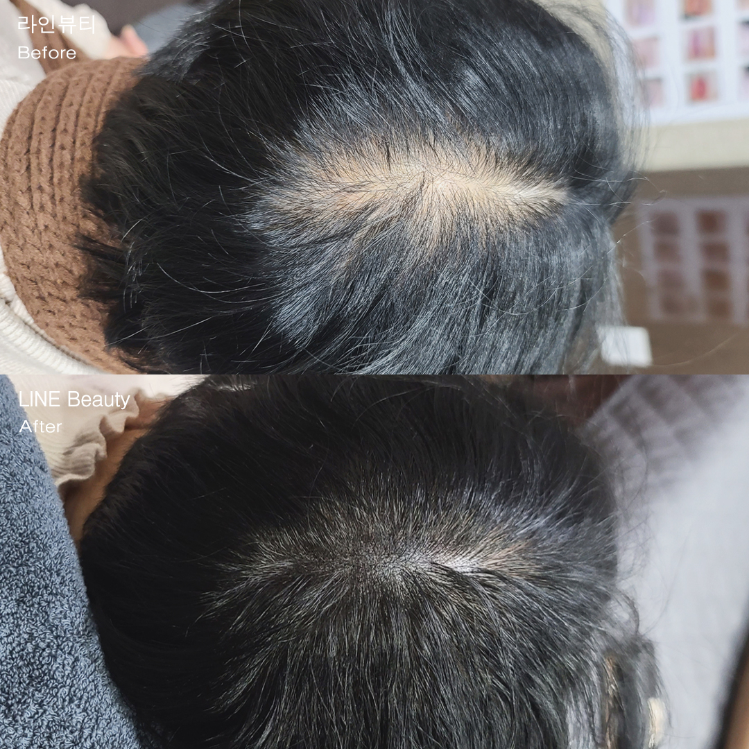 自然なヘアアートメイク(分け目アートメイク)